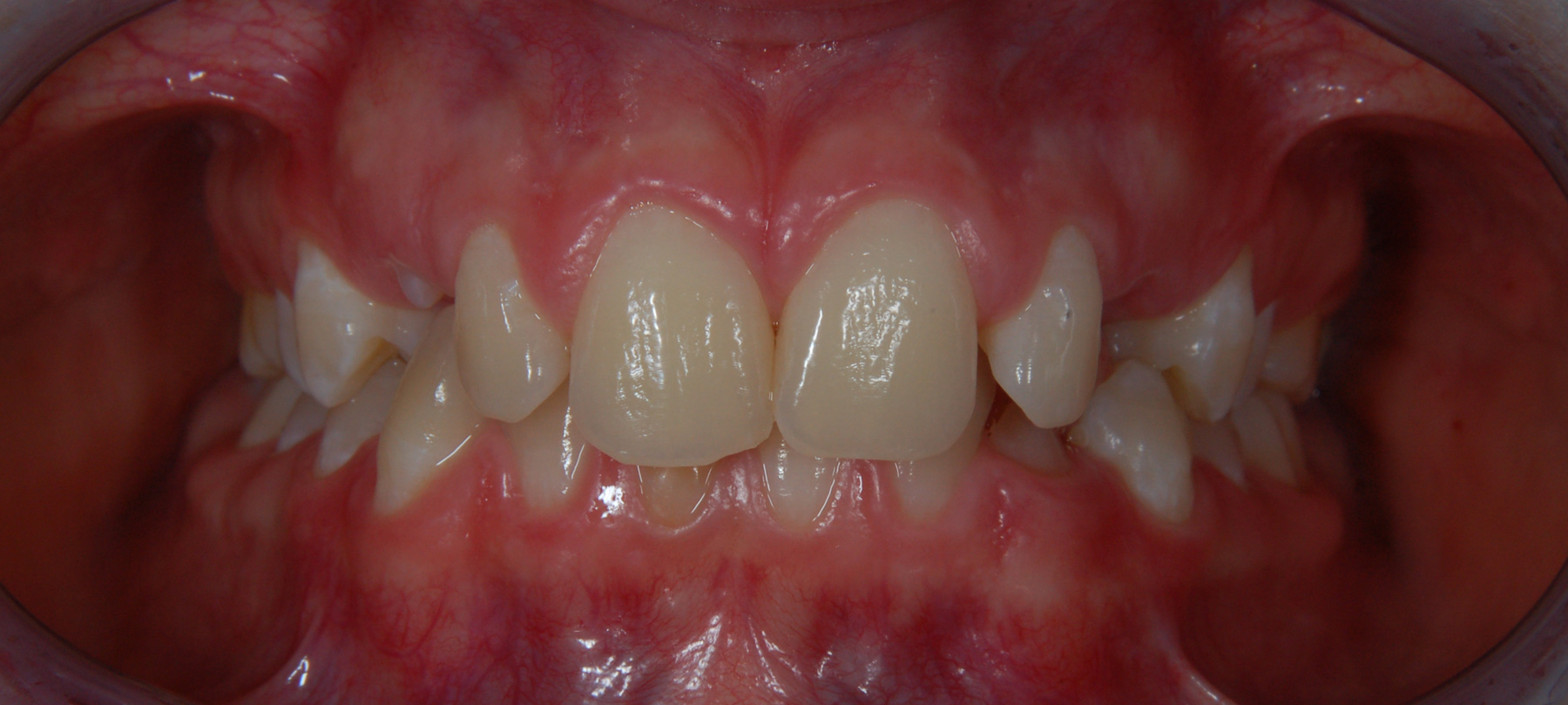 ortodonzia-01-1
