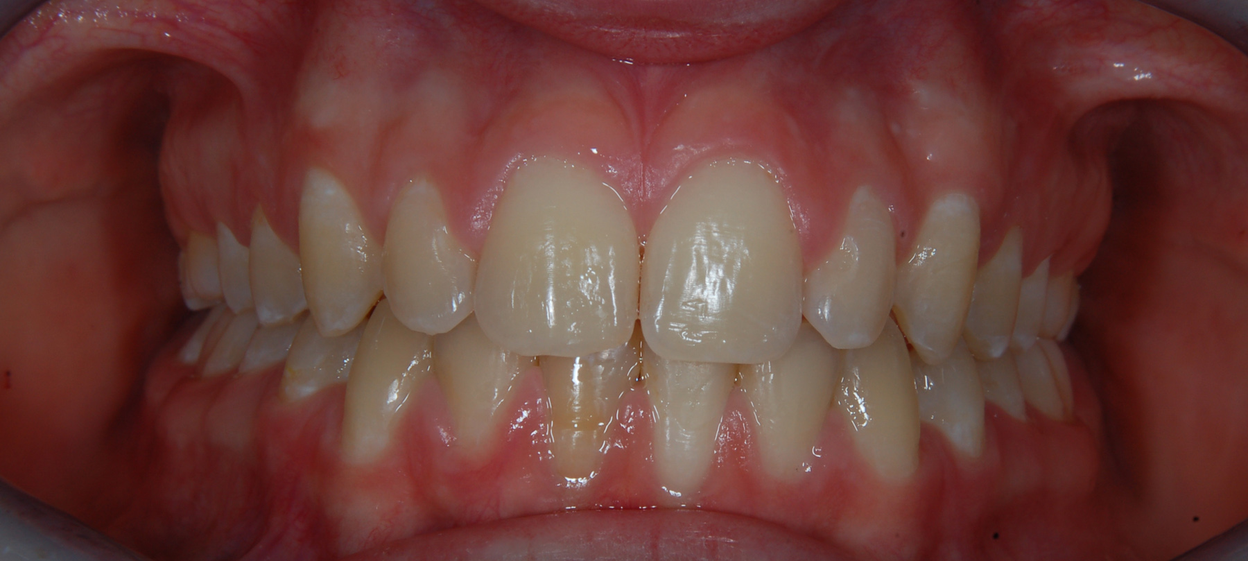 ortodonzia-01-2