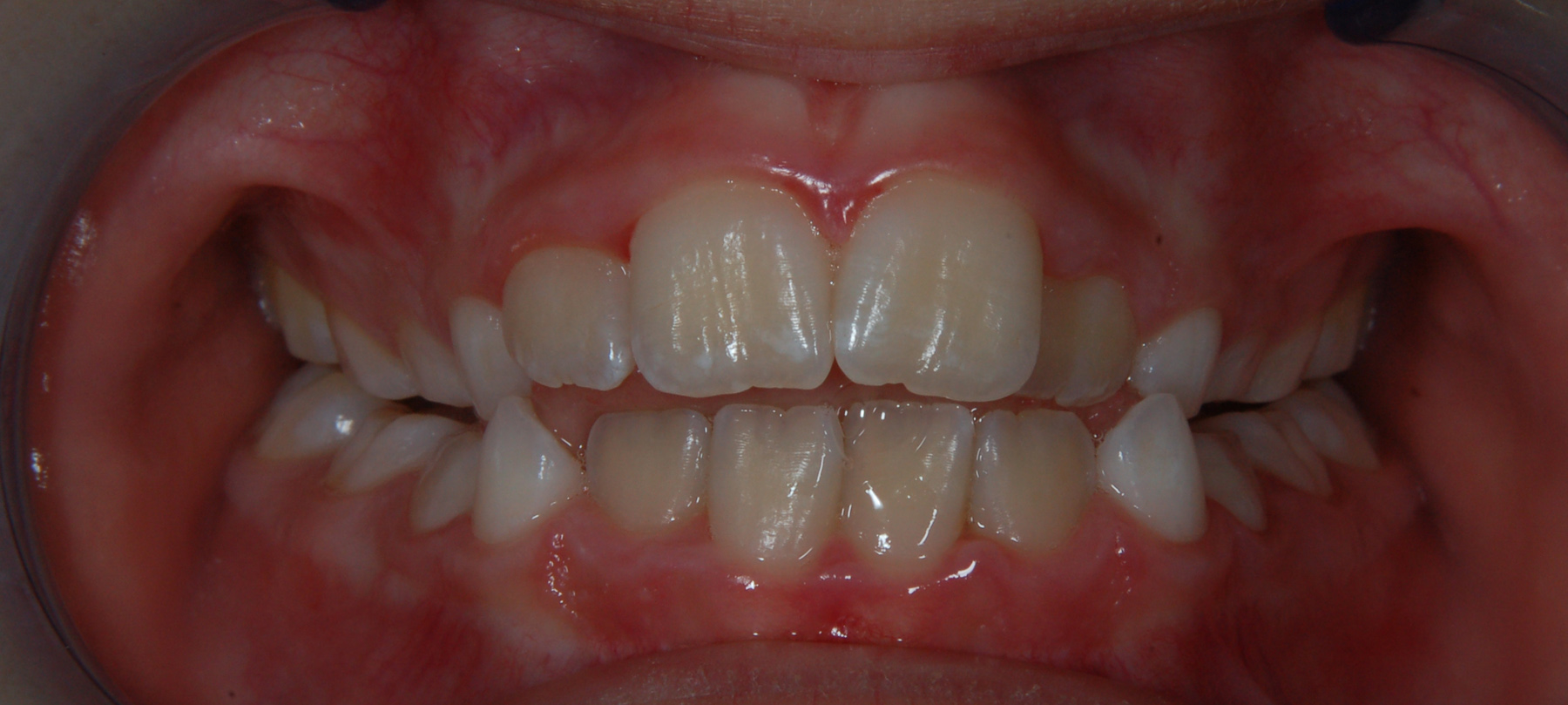 ortodonzia-02-1
