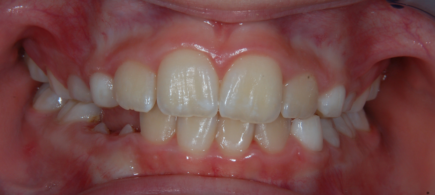 ortodonzia-02-2