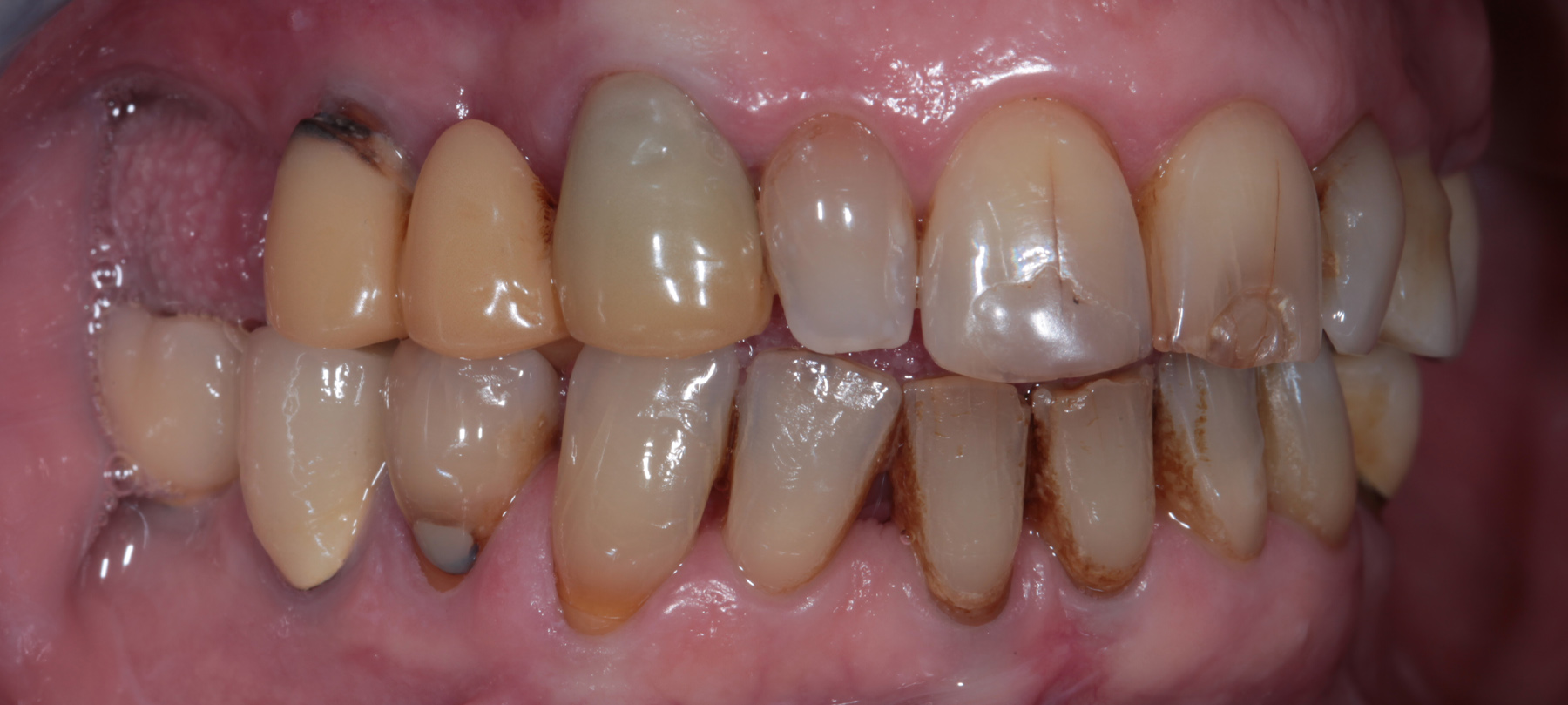 profesi-fissa-01-01-h