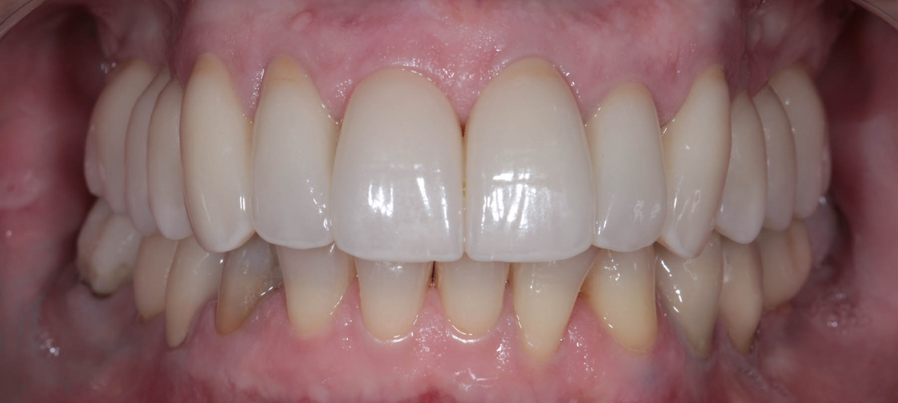 profesi-fissa-03-02b