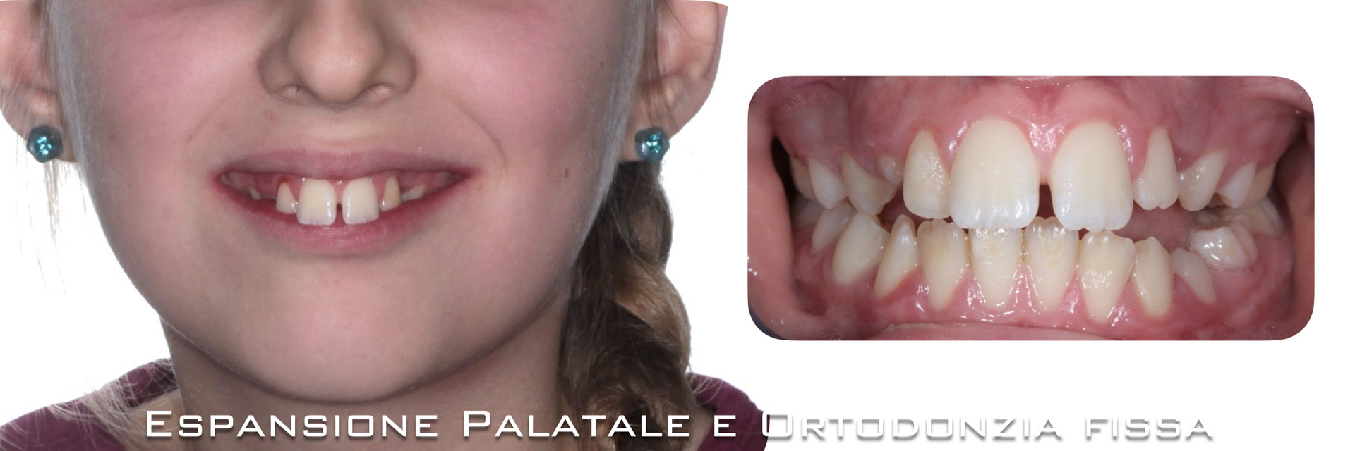 ‎pisoni-ortodonzia.‎001