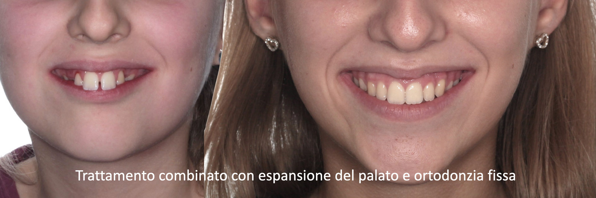 ‎pisoni-ortodonzia.‎006