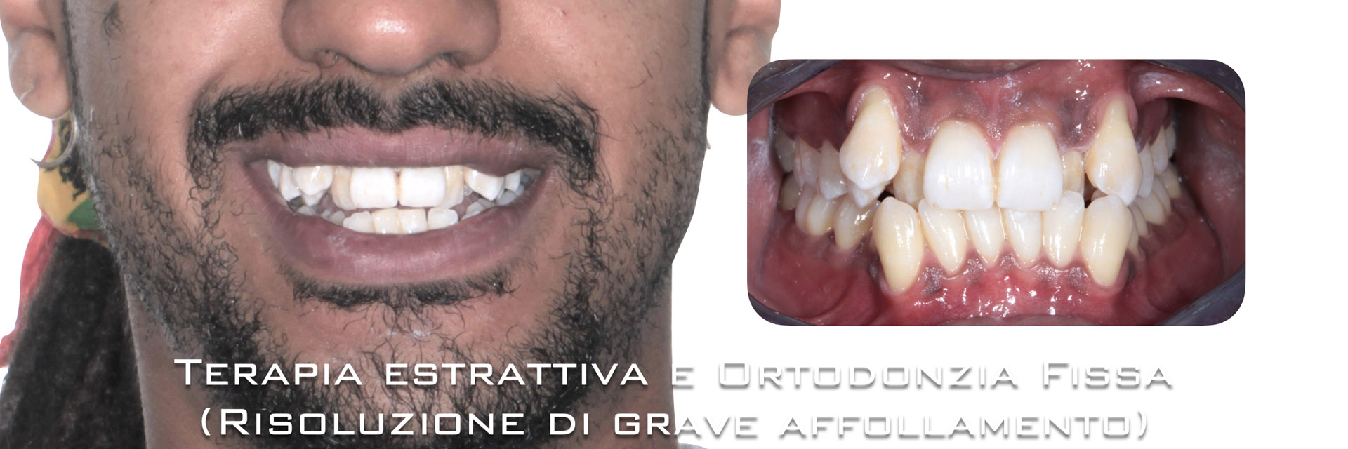 ‎pisoni-ortodonzia.‎008