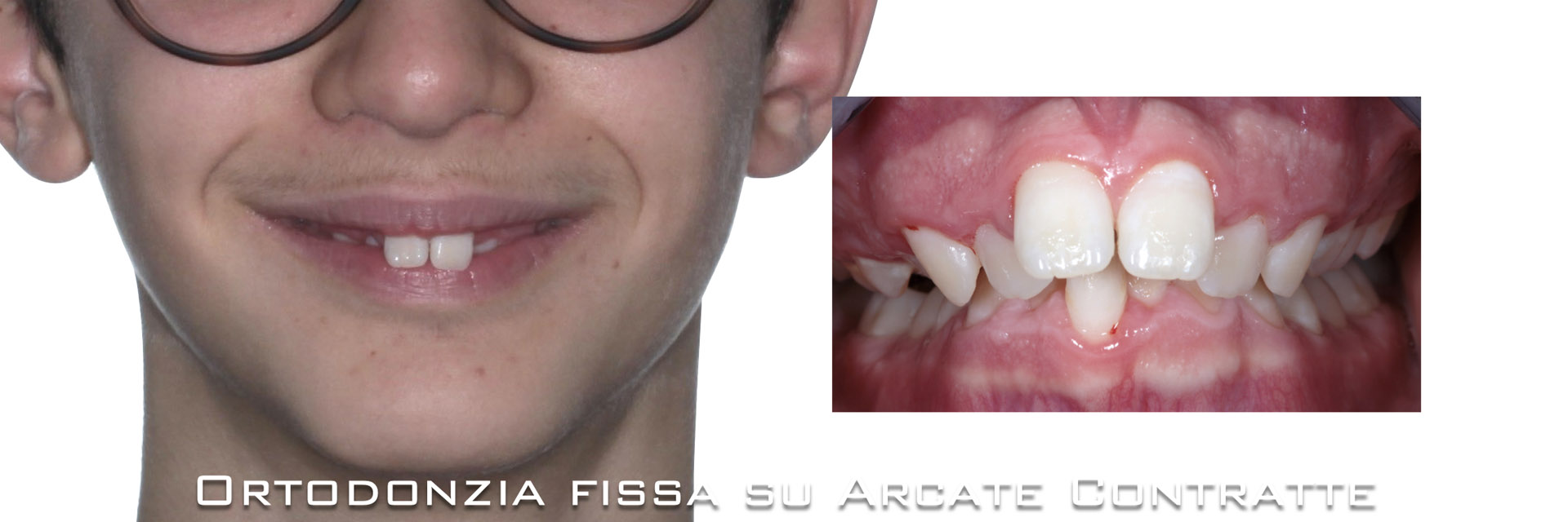 ‎pisoni-ortodonzia.‎018