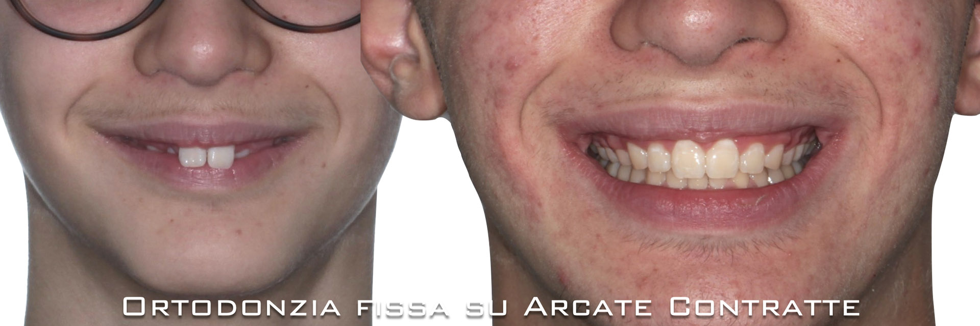 ‎pisoni-ortodonzia.‎023