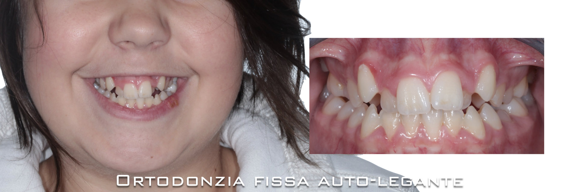 ‎pisoni-ortodonzia.‎025