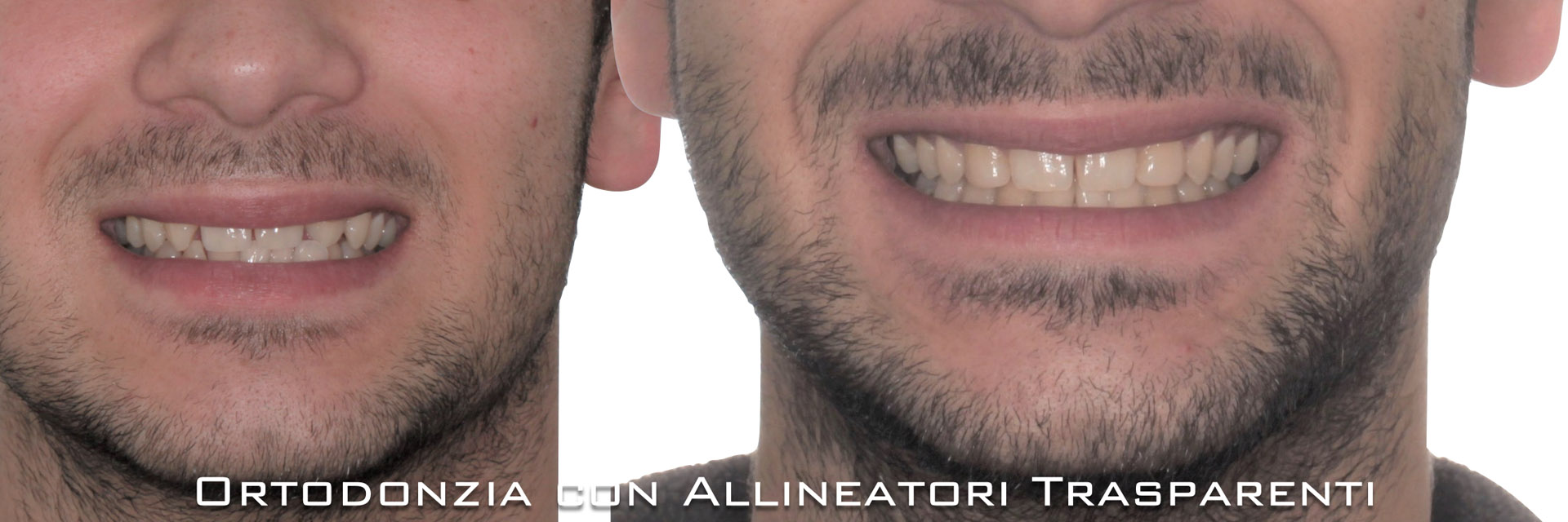 ‎pisoni-ortodonzia.‎072